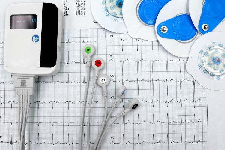 Tele-EKG